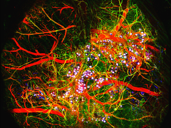 Picture of Human Organoid Project