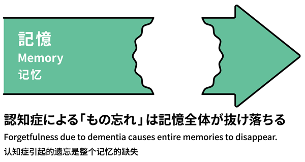 認知症による「物忘れ」は記憶全体が抜け落ちる